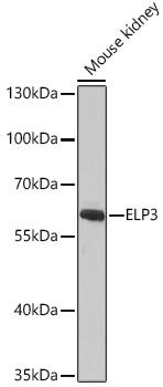 ELP3 Antibody - Western blot analysis of extracts of Mouse kidney using ELP3 Polyclonal Antibody at dilution of 1:1000.
