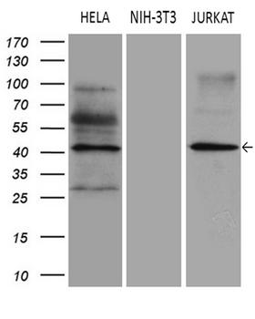 ELP4 Antibody - Western blot analysis of extracts. (35ug) from 3 different cell lines by using anti-ELP4 monoclonal antibody. (1:500)