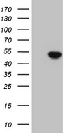ELP4 Antibody - HEK293T cells were transfected with the pCMV6-ENTRY control. (Left lane) or pCMV6-ENTRY ELP4. (Right lane) cDNA for 48 hrs and lysed. Equivalent amounts of cell lysates. (5 ug per lane) were separated by SDS-PAGE and immunoblotted with anti-ELP4. (1:2000)