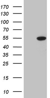 ELP4 Antibody - HEK293T cells were transfected with the pCMV6-ENTRY control. (Left lane) or pCMV6-ENTRY ELP4. (Right lane) cDNA for 48 hrs and lysed. Equivalent amounts of cell lysates. (5 ug per lane) were separated by SDS-PAGE and immunoblotted with anti-ELP4. (1:2000)