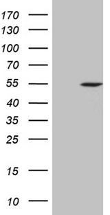 ELP4 Antibody - HEK293T cells were transfected with the pCMV6-ENTRY control. (Left lane) or pCMV6-ENTRY ELP4. (Right lane) cDNA for 48 hrs and lysed. Equivalent amounts of cell lysates. (5 ug per lane) were separated by SDS-PAGE and immunoblotted with anti-ELP4. (1:500)