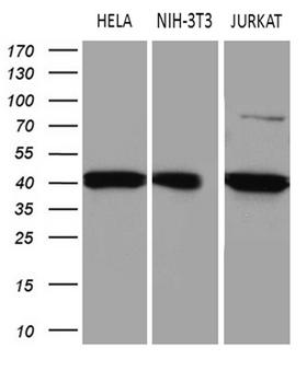 ELP4 Antibody - Western blot analysis of extracts. (35ug) from 3 different cell lines by using anti-ELP4 monoclonal antibody. (1:500)