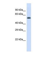 ELP4 Antibody - Western blot of Human Fetal Heart. ELP4 antibody dilution 1.0 ug/ml.  This image was taken for the unconjugated form of this product. Other forms have not been tested.