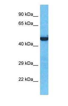 ELP4 Antibody - Western blot of ELP4 Antibody with human HCT15 Whole Cell lysate.  This image was taken for the unconjugated form of this product. Other forms have not been tested.