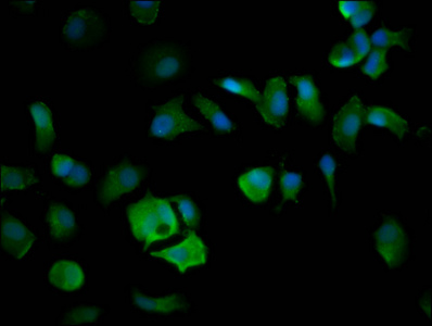 ELP4 Antibody - Immunofluorescence staining of MCF-7 cells diluted at 1:200, counter-stained with DAPI. The cells were fixed in 4% formaldehyde, permeabilized using 0.2% Triton X-100 and blocked in 10% normal Goat Serum. The cells were then incubated with the antibody overnight at 4°C.The Secondary antibody was Alexa Fluor 488-congugated AffiniPure Goat Anti-Rabbit IgG (H+L).
