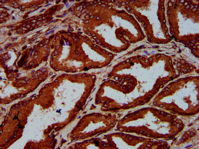 ELP4 Antibody - Immunohistochemistry Dilution at 1:600 and staining in paraffin-embedded human prostate tissue performed on a Leica BondTM system. After dewaxing and hydration, antigen retrieval was mediated by high pressure in a citrate buffer (pH 6.0). Section was blocked with 10% normal Goat serum 30min at RT. Then primary antibody (1% BSA) was incubated at 4°C overnight. The primary is detected by a biotinylated Secondary antibody and visualized using an HRP conjugated SP system.