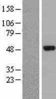 ELP4 Protein - Western validation with an anti-DDK antibody * L: Control HEK293 lysate R: Over-expression lysate