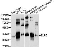 ELP5 Antibody - Western blot analysis of extracts of various cell lines, using ELP5 antibody at 1:1000 dilution. The secondary antibody used was an HRP Goat Anti-Rabbit IgG (H+L) at 1:10000 dilution. Lysates were loaded 25ug per lane and 3% nonfat dry milk in TBST was used for blocking. An ECL Kit was used for detection and the exposure time was 30s.