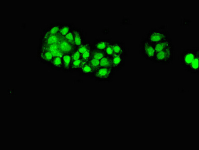ELP6 Antibody - Immunofluorescent analysis of PC3 cells diluted at 1:100 and Alexa Fluor 488-congugated AffiniPure Goat Anti-Rabbit IgG(H+L)