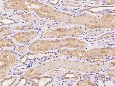 ELP6 Antibody - Immunochemical staining of human C3orf75 in human kidney with rabbit polyclonal antibody at 1:100 dilution, formalin-fixed paraffin embedded sections.