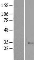 ELP6 Protein - Western validation with an anti-DDK antibody * L: Control HEK293 lysate R: Over-expression lysate
