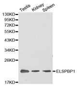 ELSPBP1 / HE12 Antibody - Western blot analysis of extracts of various cell lines, using ELSPBP1 antibody.