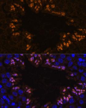 ELSPBP1 / HE12 Antibody - Immunofluorescence analysis of Mouse testis using ELSPBP1 Polyclonal Antibody at dilution of 1:100.Blue: DAPI for nuclear staining.