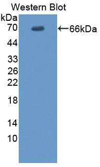 EMA / MUC1 Antibody - Western blot of EMA / MUC1 antibody.