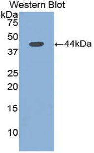 EMA / MUC1 Antibody - Western blot of recombinant EMA / MUC1.