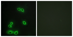EMA / MUC1 Antibody - Immunofluorescence of A549 cells, using MUC1 Antibody. The sample on the right was incubated with synthetic peptide.