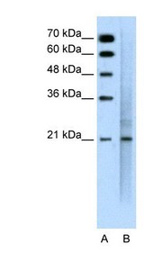 EMA / MUC1 Antibody - Western Blot: MUC1 Antibody - TGF-beta1 cells, Antibody Titration: 0.2-1 ug/ml