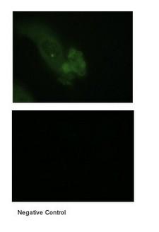 EMA / MUC1 Antibody - Immunocytochemistry/Immunofluorescence: MUC1 Antibody - Human tGF-beta1 cells tissue.