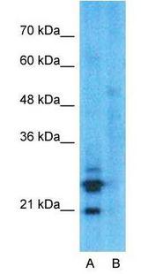 EMA / MUC1 Antibody - Western Blot: MUC1 Antibody - HepG2. Lane A: Primary Antibody. Lane B: Primary Antibody and Blocking Peptide.