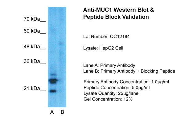 EMA / MUC1 Antibody - Western Blot: MUC1 Antibody - Sample Tissue: HepG2, Lane A: Primary Antibody, Lane B: Primary Antibody + Blocking Peptide, Primary Antibody Concentration: 1ug/ml, Peptide Concentration: 5ug/ml, Lysate Quantity: 25ug/lane/lane, Gel Concentration: 0.12