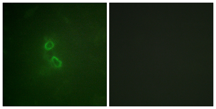 EMA / MUC1 Antibody - Immunofluorescence analysis of COS7 cells, using CD227/MUC1 Antibody. The picture on the right is blocked with the synthesized peptide.