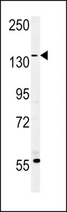 EMA / MUC1 Antibody - MUC1-T1224 Antibody western blot of MDA-MB435 cell line lysates (35 ug/lane). The MUC1 antibody detected the MUC1 protein (arrow).