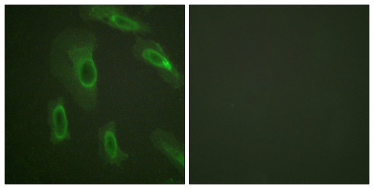 EMA / MUC1 Antibody - Immunofluorescence analysis of HeLa cells, using CD227/Mucin 1 Antibody. The picture on the right is blocked with the synthesized peptide.