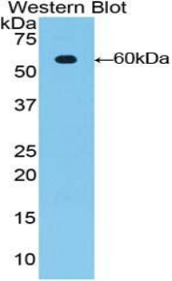 EMA / MUC1 Antibody - Western blot of recombinant EMA / MUC1.  This image was taken for the unconjugated form of this product. Other forms have not been tested.