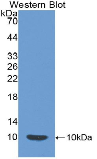 EMA / MUC1 Antibody - Western blot of recombinant EMA / MUC1.  This image was taken for the unconjugated form of this product. Other forms have not been tested.