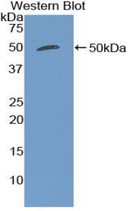 EMA / MUC1 Antibody - Western blot of recombinant EMA / MUC1.