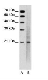 EMA / MUC1 Antibody - A: Marker, B: Jurkat Cell Lysate.  This image was taken for the unconjugated form of this product. Other forms have not been tested.
