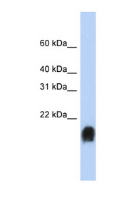 EMA / MUC1 Antibody - MUC1 / Episialin antibody Western blot of Jurkat lysate. This image was taken for the unconjugated form of this product. Other forms have not been tested.
