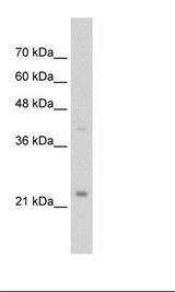 EMA / MUC1 Antibody - Jurkat Cell Lysate.  This image was taken for the unconjugated form of this product. Other forms have not been tested.