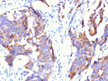 EMA / MUC1 Antibody - IHC testing of FFPE human stomach with MUC1 antibody (clone 115D8). HIER: requires steaming of sections in 10mM citrate buffer, pH 6, for 10-20 min.