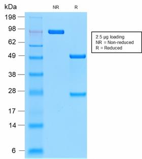EMA / MUC1 Antibody - SDS-PAGE Analysis Purified MUC1 Rabbit Recombinant Monoclonal Antibody (MUC1/2278R). Confirmation of Purity and Integrity of Antibody.