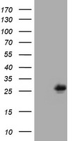 EMA / MUC1 Antibody - HEK293T cells were transfected with the pCMV6-ENTRY control (Left lane) or pCMV6-ENTRY MUC1 (Right lane) cDNA for 48 hrs and lysed. Equivalent amounts of cell lysates (5 ug per lane) were separated by SDS-PAGE and immunoblotted with anti-MUC1.