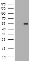 EMA / MUC1 Antibody - HEK293T cells were transfected with the pCMV6-ENTRY control (Left lane) or pCMV6-ENTRY MUC1 (Right lane) cDNA for 48 hrs and lysed. Equivalent amounts of cell lysates (5 ug per lane) were separated by SDS-PAGE and immunoblotted with anti-MUC1.