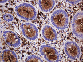 EMA / MUC1 Antibody - IHC of paraffin-embedded Human colon tissue using anti-MUC1 mouse monoclonal antibody.
