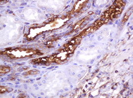 EMA / MUC1 Antibody - IHC of paraffin-embedded Human Kidney tissue using anti-MUC1 mouse monoclonal antibody.