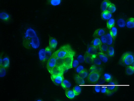 EMA / MUC1 Antibody - Immunofluorescent staining of MCF-7 cells using anti-${SYMBOL} mouse monoclonal antibody.