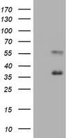 EMA / MUC1 Antibody - HEK293T cells were transfected with the pCMV6-ENTRY control (Left lane) or pCMV6-ENTRY MUC1 (Right lane) cDNA for 48 hrs and lysed. Equivalent amounts of cell lysates (5 ug per lane) were separated by SDS-PAGE and immunoblotted with anti-MUC1.