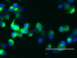 EMA / MUC1 Antibody - Immunofluorescent staining of MCF-7 cells using anti-${SYMBOL} mouse monoclonal antibody.