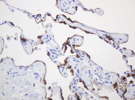 EMA / MUC1 Antibody - IHC of paraffin-embedded Human lung tissue using anti-MUC1 mouse monoclonal antibody.