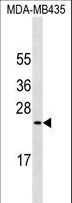 EMA / MUC1 Antibody - MUC1 Antibody western blot of MDA-MB435 cell line lysates (35 ug/lane). The MUC1 antibody detected the MUC1 protein (arrow).