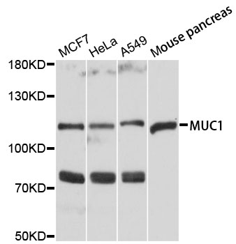 EMA / MUC1 Antibody - Western blot analysis of extracts of various cell lines, using MUC1 antibody at 1:3000 dilution. The secondary antibody used was an HRP Goat Anti-Rabbit IgG (H+L) at 1:10000 dilution. Lysates were loaded 25ug per lane and 3% nonfat dry milk in TBST was used for blocking. An ECL Kit was used for detection and the exposure time was 1s.