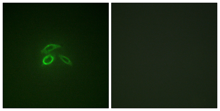 EMA / MUC1 Antibody - Immunofluorescence analysis of HepG2 cells, using CD227/MUC1 (Phospho-Tyr1229) Antibody. The picture on the right is blocked with the phospho peptide.