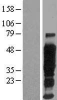 EMA / MUC1 Protein - Western validation with an anti-DDK antibody * L: Control HEK293 lysate R: Over-expression lysate