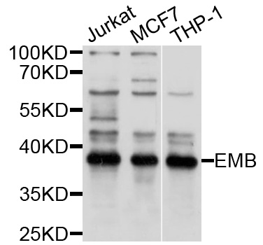 EMB/ Embigin Antibody - Western blot analysis of extracts of various cell lines, using EMB antibody at 1:1000 dilution. The secondary antibody used was an HRP Goat Anti-Rabbit IgG (H+L) at 1:10000 dilution. Lysates were loaded 25ug per lane and 3% nonfat dry milk in TBST was used for blocking. An ECL Kit was used for detection and the exposure time was 5s.