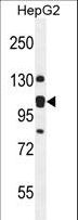 EMC1 Antibody - K0090 Antibody western blot of HepG2 cell line lysates (35 ug/lane). The K0090 antibody detected the K0090 protein (arrow).