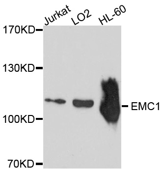 EMC1 Antibody - Western blot analysis of extracts of various cell lines, using EMC1 antibody at 1:1000 dilution. The secondary antibody used was an HRP Goat Anti-Rabbit IgG (H+L) at 1:10000 dilution. Lysates were loaded 25ug per lane and 3% nonfat dry milk in TBST was used for blocking. An ECL Kit was used for detection and the exposure time was 90s.